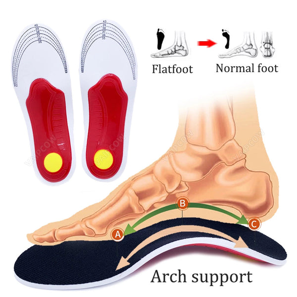 Steppie™ Arch Clouds - Orthopedic Arch Support Insoles Steppie